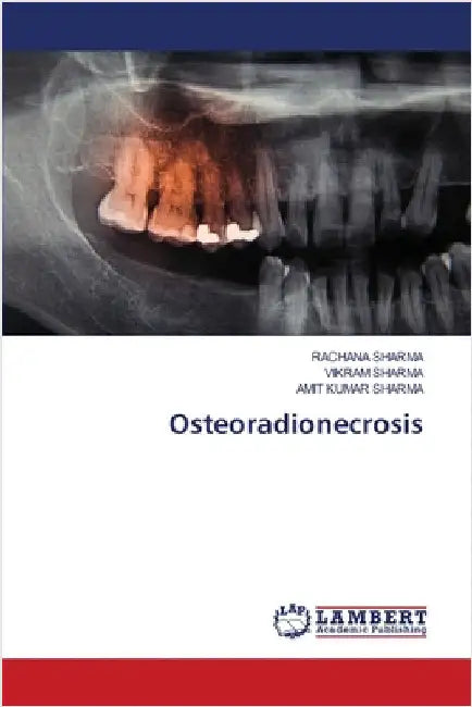 Osteoradionecrosis by Rachana Sharma