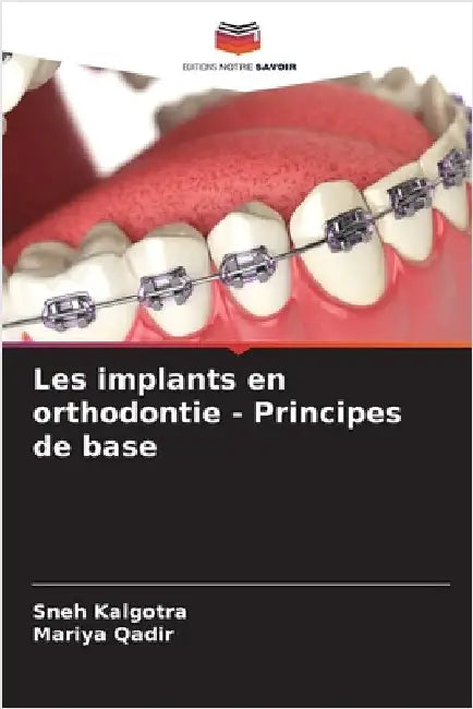 Les implants en orthodontie - Principes de base by Kalgotra, Sneh