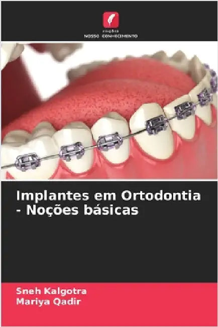 Implantes em Ortodontia - Noções básicas by Sneh Kalgotra