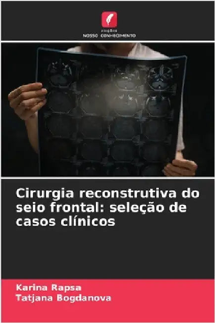 Cirurgia reconstrutiva do seio frontal: seleção de casos clínicos by Karina Rapsa
