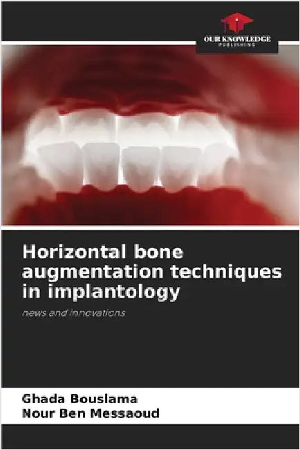 Horizontal bone augmentation techniques in implantology by Ghada Bouslama