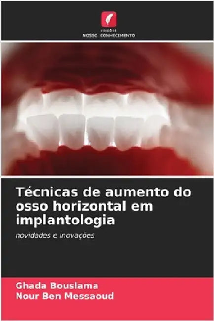 Técnicas de aumento do osso horizontal em implantologia by Bouslama, Ghada