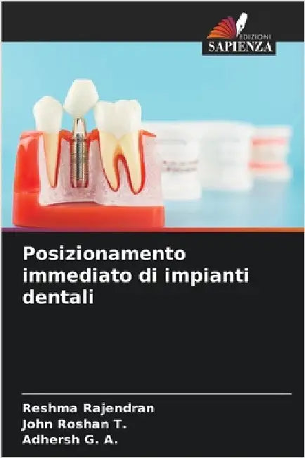 Posizionamento immediato di impianti dentali by Reshma Rajendran