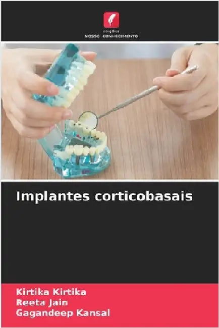 Implantes corticobasais by Kirtika, Kirtika