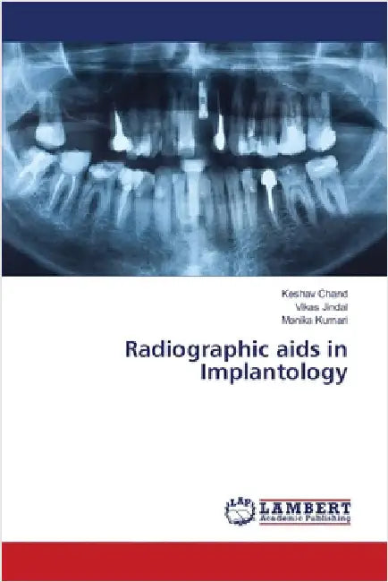 Radiographic aids in Implantology by Chand, Keshav