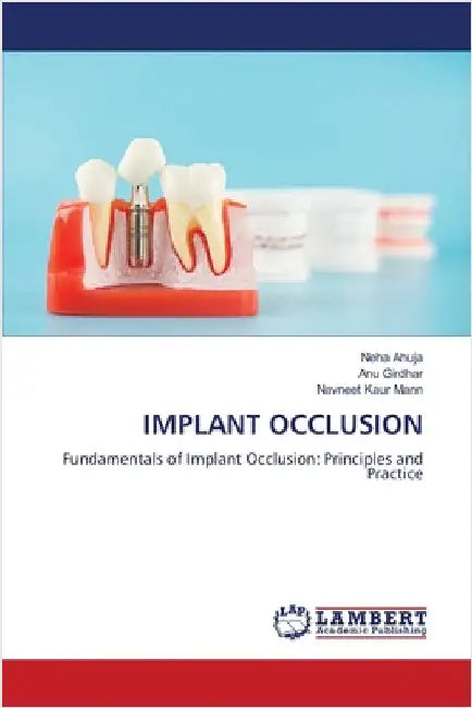 Implant Occlusion by Neha Ahuja