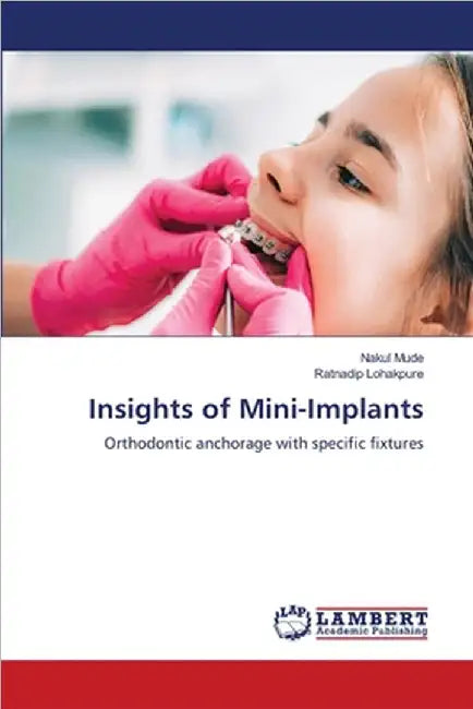 Insights of Mini-Implants by Mude, Nakul
