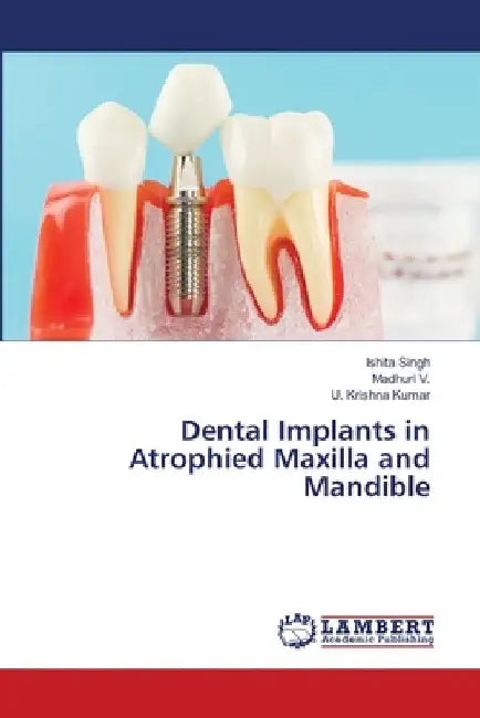Dental Implants in Atrophied Maxilla and Mandible by Ishita Singh