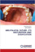 Mid-Palatal Suture- It's Maturation and Ossification by Shantanu Raut