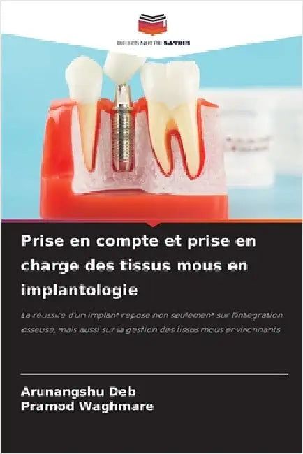 Prise en compte et prise en charge des tissus mous en implantologie by Deb, Arunangshu