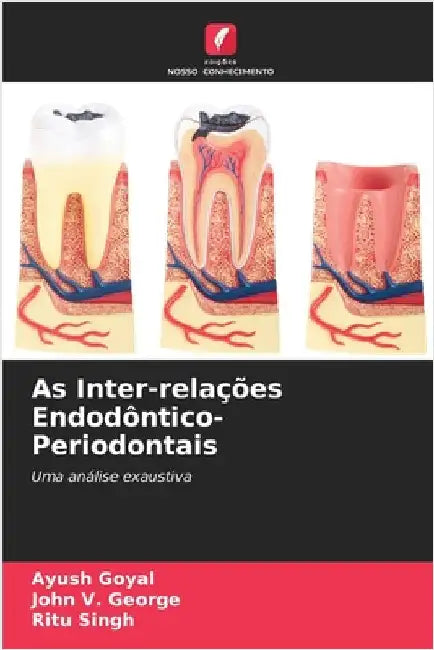 As Inter-relações Endodôntico-Periodontais by Ayush Goyal