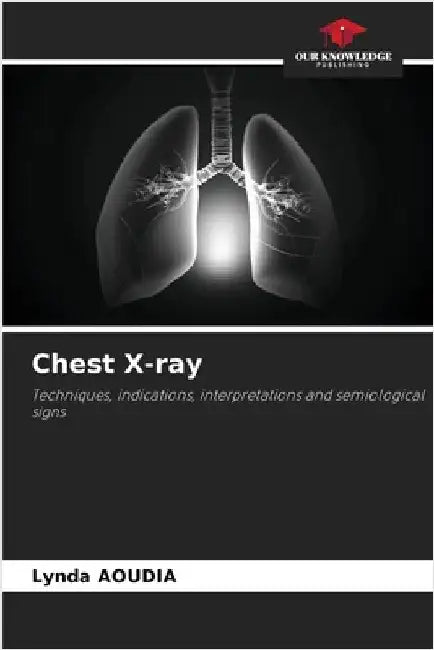 Chest X-ray by Aoudia, Lynda