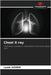 Chest X-ray by Aoudia, Lynda