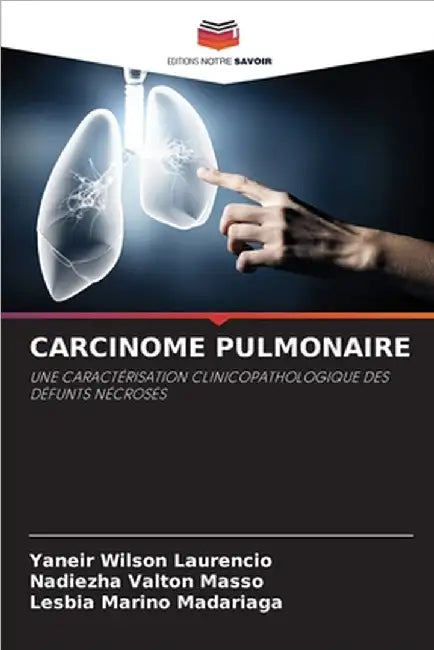 Carcinome Pulmonaire by Yaneir Wilson Laurencio