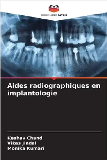 Aides radiographiques en implantologie by Keshav Chand