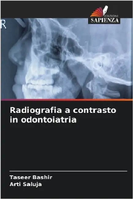 Radiografia a contrasto in odontoiatria by Taseer Bashir