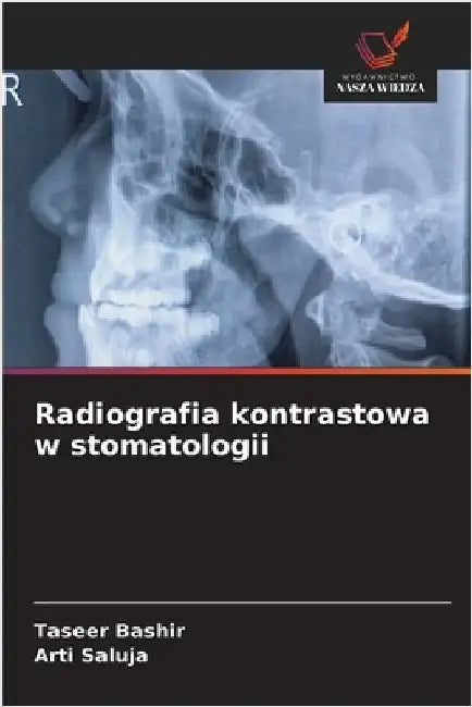 Radiografia kontrastowa w stomatologii by Bashir, Taseer
