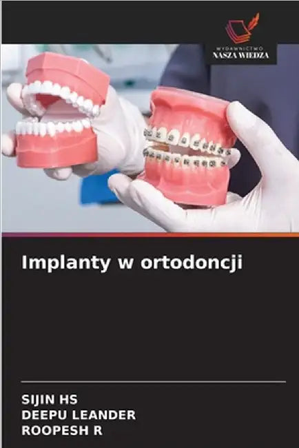 Implanty w ortodoncji by Sijin Hs