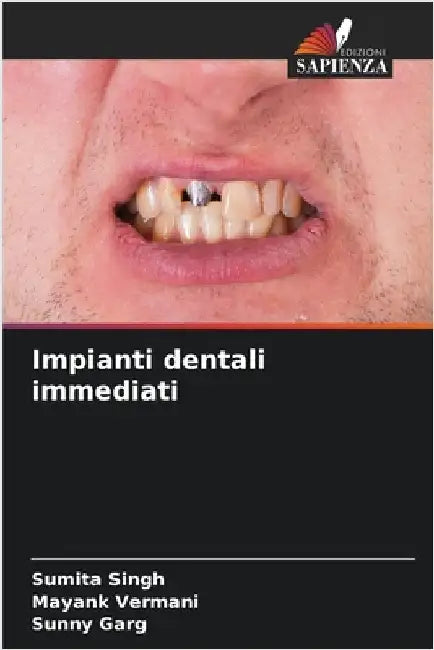Impianti dentali immediati by Sumita Singh