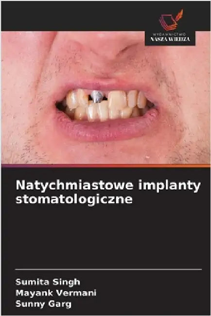 Natychmiastowe implanty stomatologiczne by Singh, Sumita
