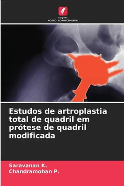 Estudos de artroplastia total de quadril em prótese de quadril modificada by Saravanan K