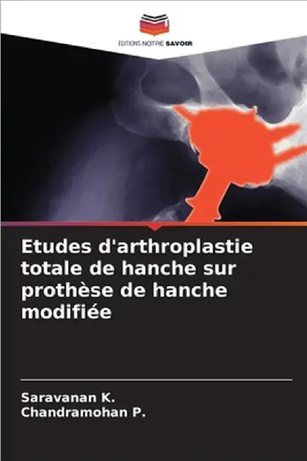 Etudes d'arthroplastie totale de hanche sur prothèse de hanche modifiée by Saravanan K
