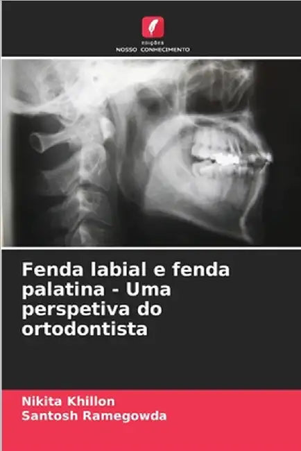 Fenda labial e fenda palatina - Uma perspetiva do ortodontista by Khillon, Nikita