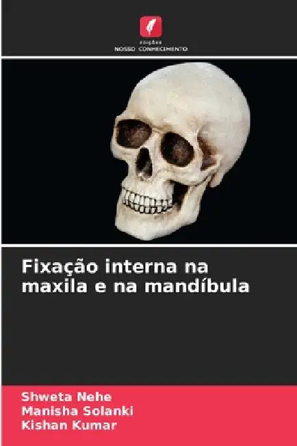 Fixação interna na maxila e na mandíbula by Shweta Nehe, Manisha Solanki, Kishan Kumar
