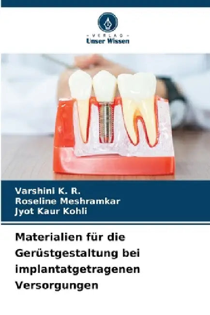 Materialien für die Gerüstgestaltung bei implantatgetragenen Versorgungen by Varshini K. R., Roseline Meshramkar, Jyot Kaur Kohli