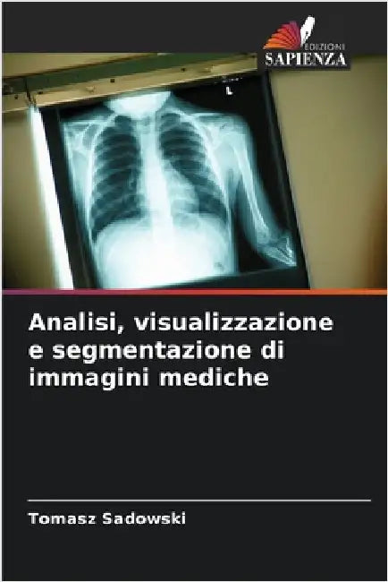 Analisi, visualizzazione e segmentazione di immagini mediche by Tomasz Sadowski