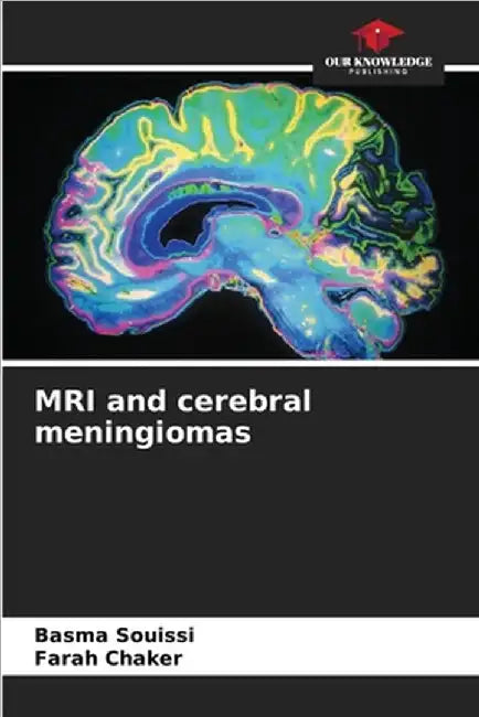 MRI and cerebral meningiomas by Souissi, Basma