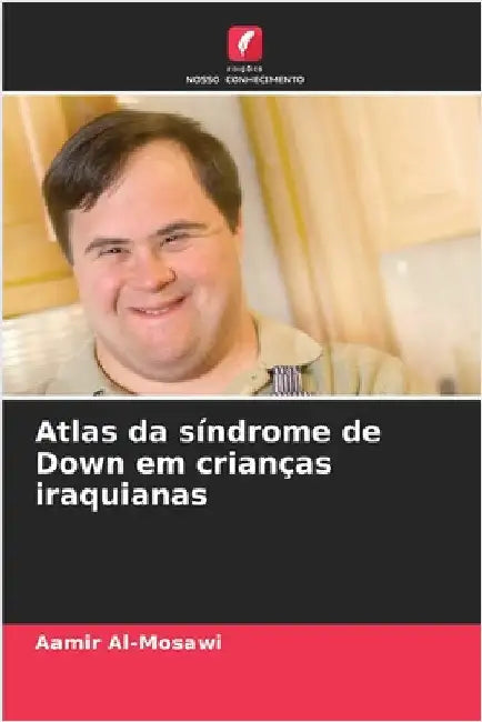 Atlas da síndrome de Down em crianças iraquianas by Al-Mosawi, Aamir