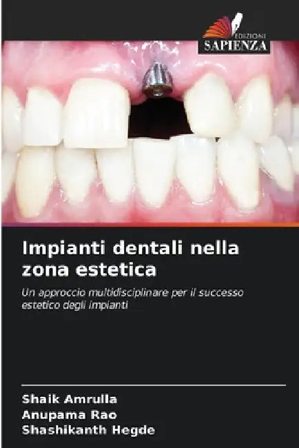 Impianti dentali nella zona estetica by Shaik Amrulla