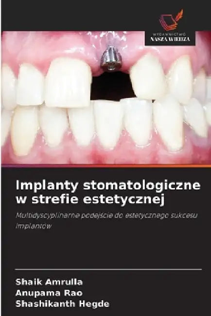 Implanty stomatologiczne w strefie estetycznej by Shaik Amrulla