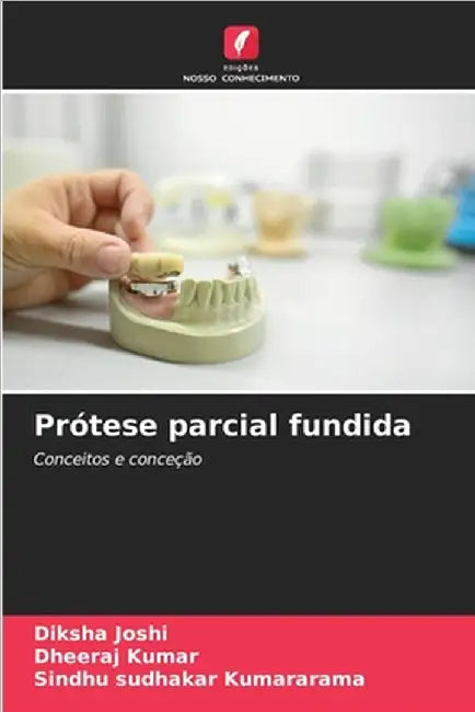 Prótese parcial fundida by Diksha Joshi