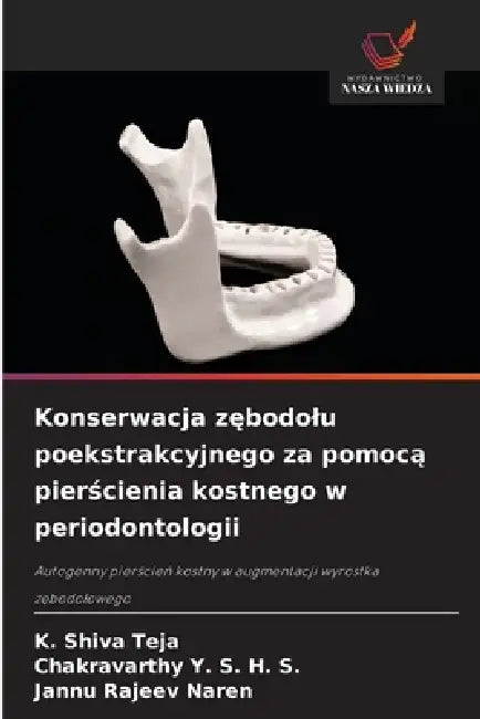 Konserwacja zębodolu poekstrakcyjnego za pomocą pierścienia kostnego w periodontologii by K. Shiva Teja, Chakravarthy Y. S. H. S., Jannu Rajeev Naren