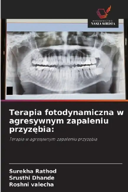 Terapia fotodynamiczna w agresywnym zapaleniu przyzębia by Surekha Rathod, Srusthi Dhande, Roshni Valecha
