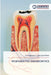 Regenerative Endodontics by Krishnaprasad L