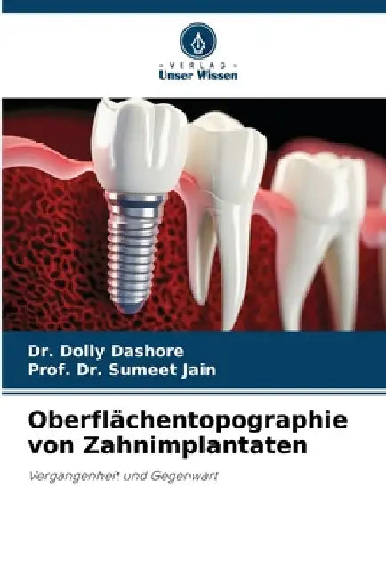 Oberflächentopographie von Zahnimplantaten by Dolly Dashore, Prof Sumeet Jain