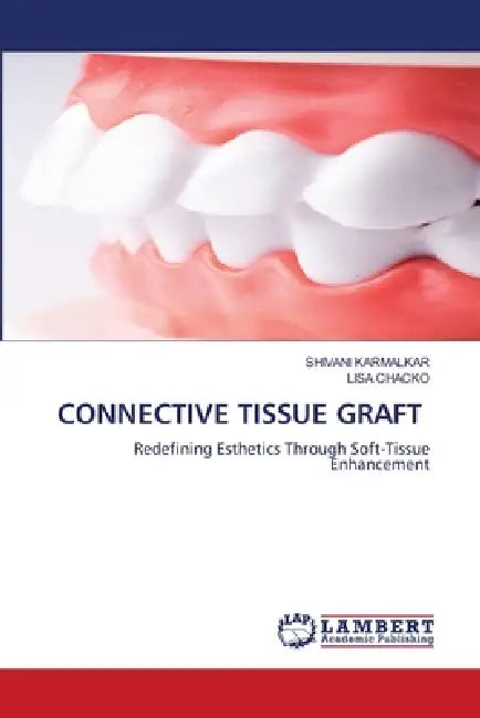 Connective Tissue Graft by Shivani Karmalkar, Lisa Chacko