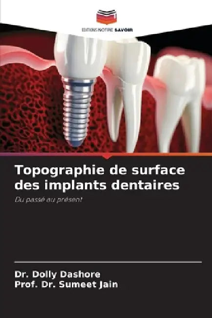 Topographie de surface des implants dentaires by Dolly Dashore, Prof Sumeet Jain