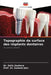 Topographie de surface des implants dentaires by Dolly Dashore, Prof Sumeet Jain