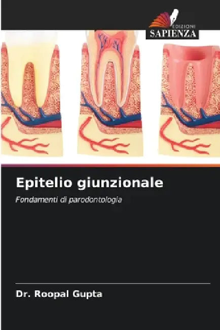 Epitelio giunzionale by Roopal Gupta