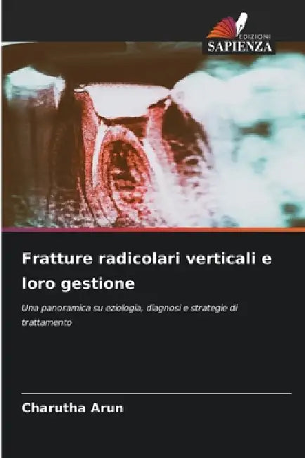Fratture radicolari verticali e loro gestione by Charutha Arun