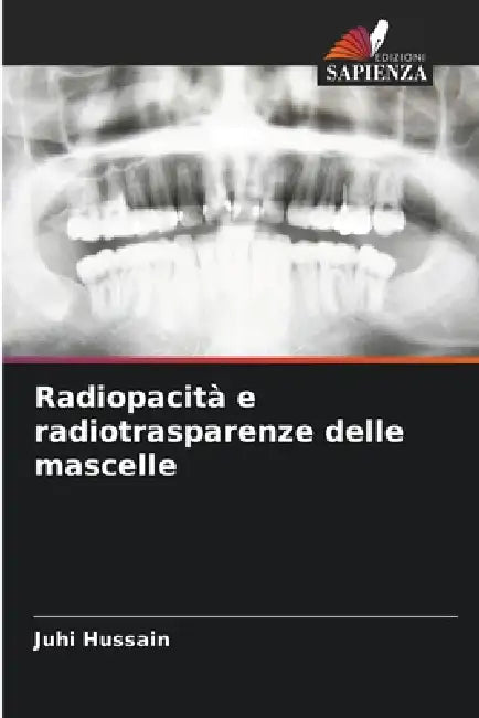 Radiopacità e radiotrasparenze delle mascelle by Juhi Hussain