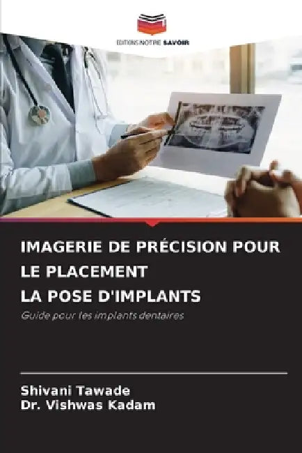 Imagerie de Précision Pour Le Placement La Pose d'Implants by Shivani Tawade, Vishwas Kadam