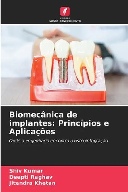 Biomecânica de implantes: Princípios e Aplicações by Shiv Kumar, Deepti Raghav, Jitendra Khetan