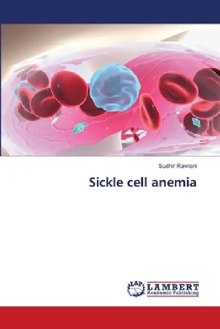 Sickle cell anemia by Sudhir Rawlani