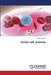 Sickle cell anemia by Sudhir Rawlani