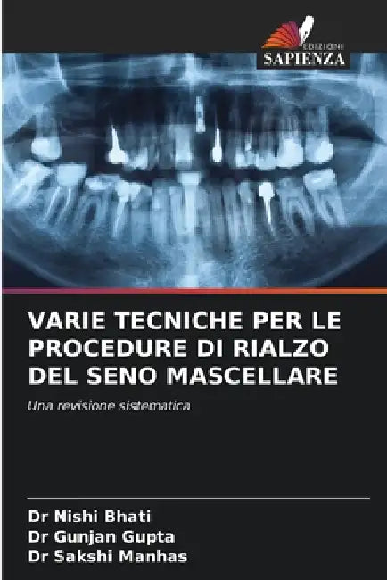 Varie Tecniche Per Le Procedure Di Rialzo del Seno Mascellare by Nishi Bhati, Gunjan Gupta, Sakshi Manhas